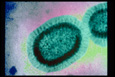 Grippe H1N1 : une vaccination spécifique sur rendez-vous pour les allergiques à l'oeuf