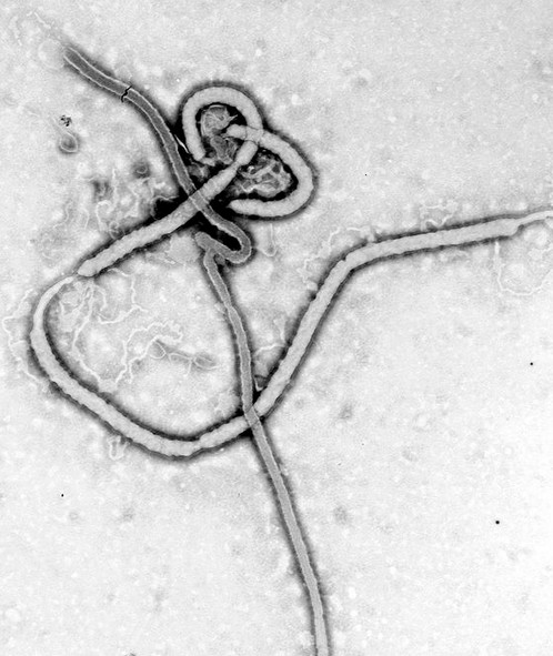 Un vaccin efficace contre le virus Ebola