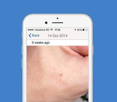 Dermatologie : LEO Pharma investit dans les applications mobiles 