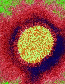 Virus de la grippe / Leem