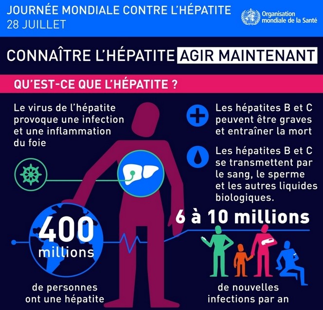  Journée mondiale contre l’hépatite : la maladie en infographie