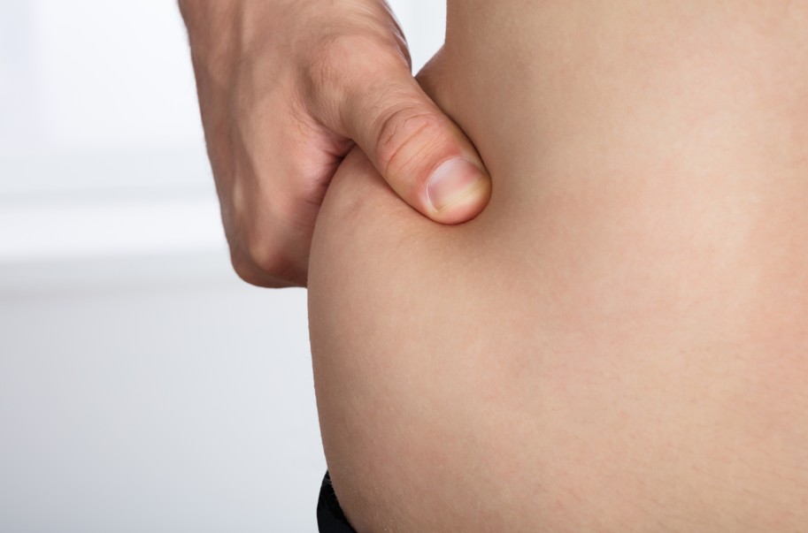 Comment perdre les poignées d’amour ?